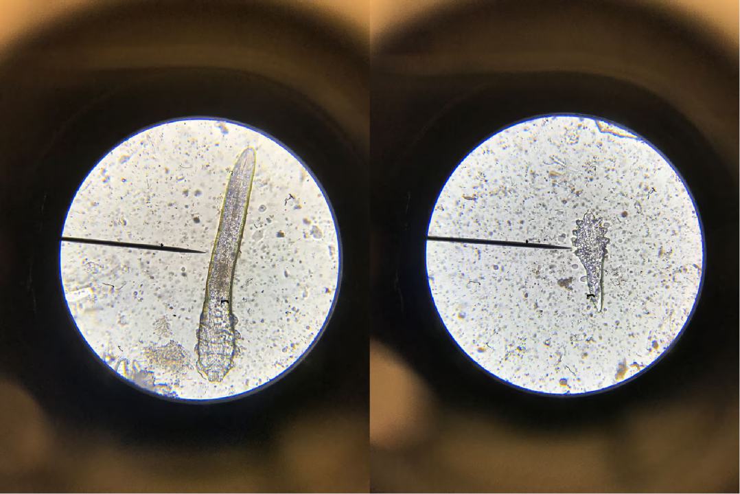 每日一学|你所不知道的螨虫